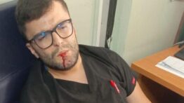 İskenderun’da Sağlık Personeline Saldırı! – Tek Haber Ajansı (TEKHA) Türkiye’nin Habercisi