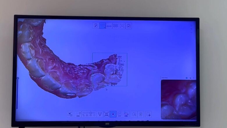  Diş Hekimliğinde Dijital Dönüşüm: Konforlu ve Hızlı Tedavi Dönemi Başladı